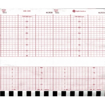 CMS 4305 Chart Paper 152mm X 47'