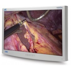 NDS 32in ENDOVUE PLUS 4K
