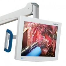 NDS 19in EndoVue
