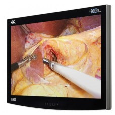 NDS 32in RADIANCE ULTRA 4K UHD