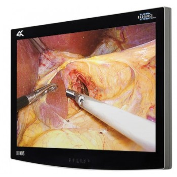 NDS 32in RADIANCE ULTRA 4K UHD