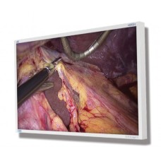 NDS 55in ENDOVUE PLUS 4K with 12G-SDI and Quad-Link