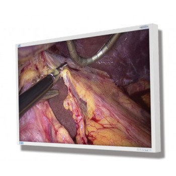 NDS 55in ENDOVUE PLUS 4K with 12G-SDI and Quad-Link